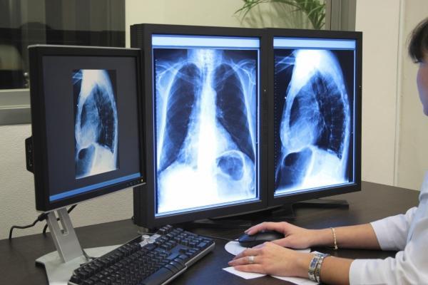Centro Médico La Unión incorporará prontamente radiología digital