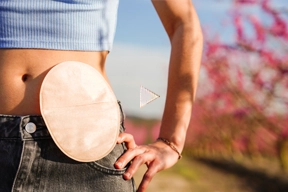 Cuidados de Ostomía en casa